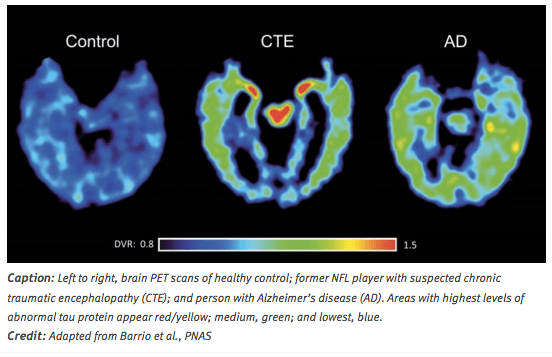 Screen Shot 2016-01-23 at 5.49.09 AM.png